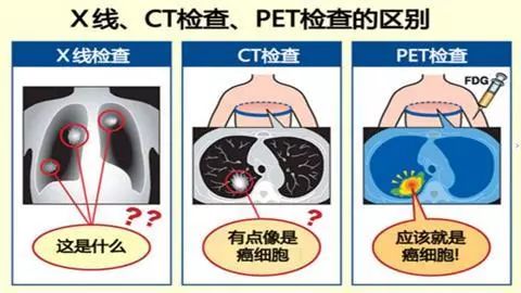 电离辐射有哪些(电离辐射对人体有哪些影响)