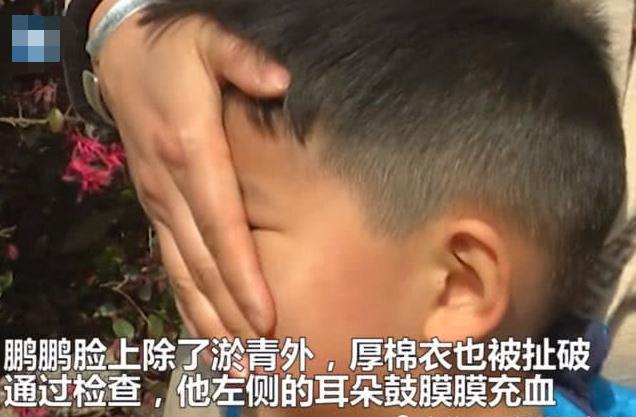 孩子被同学奶奶扇巴掌，家长：看完摄像头，原谅不了