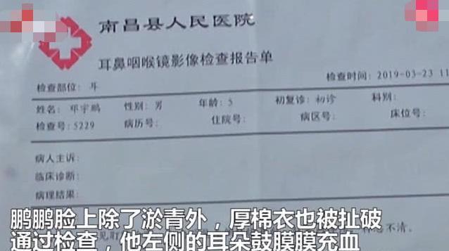 孩子被同学奶奶扇巴掌，家长：看完摄像头，原谅不了