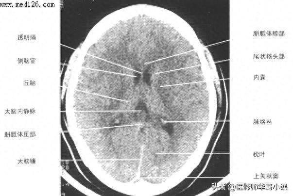 头颅（CT）解剖--精品图集