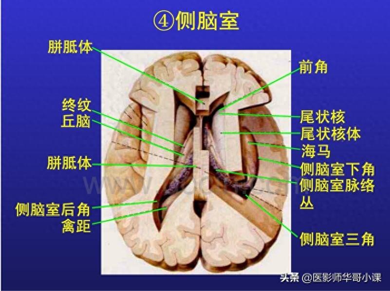 头颅（CT）解剖--精品图集