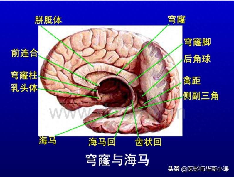 头颅（CT）解剖--精品图集