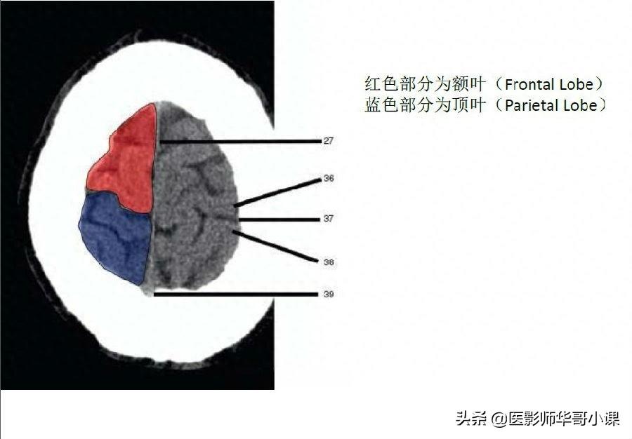 头颅（CT）解剖--精品图集