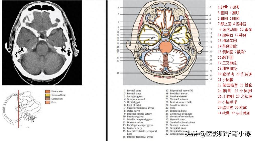 头颅（CT）解剖--精品图集