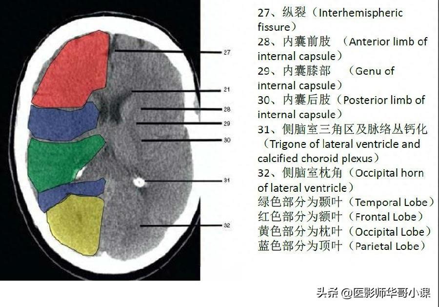 头颅（CT）解剖--精品图集