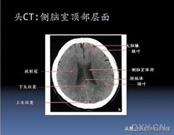 头颅（CT）解剖--精品图集