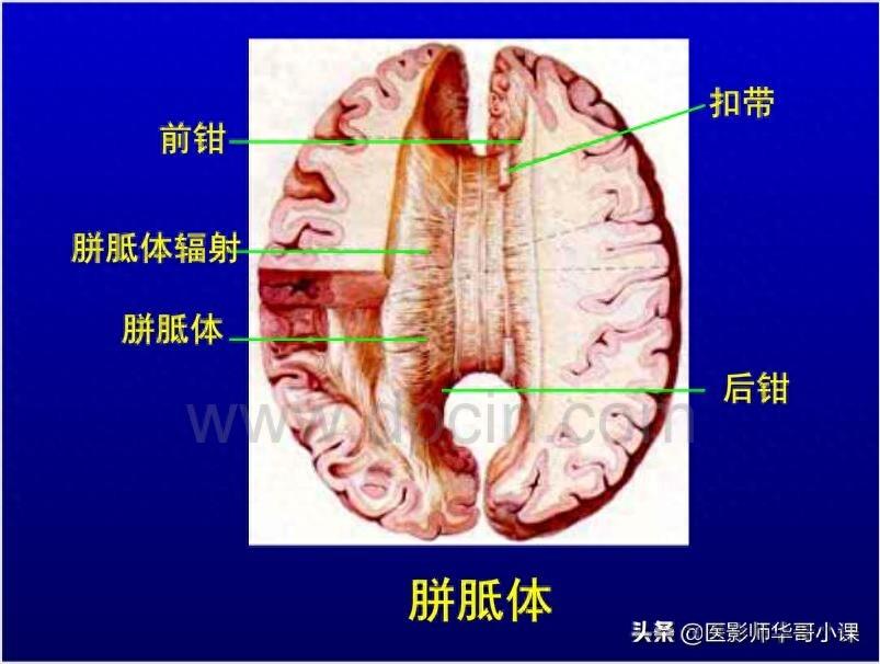 头颅（CT）解剖--精品图集