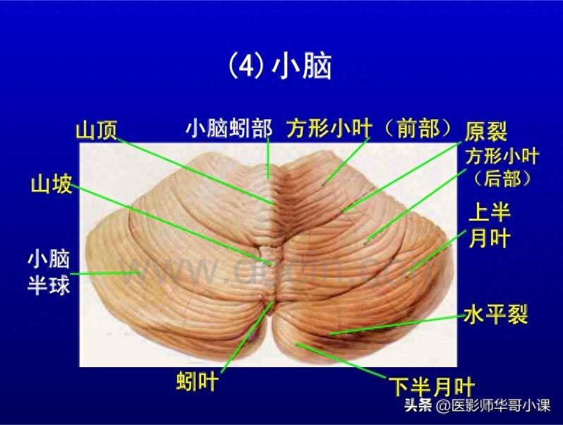 头颅（CT）解剖--精品图集