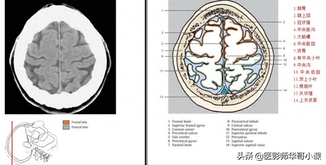 头颅（CT）解剖--精品图集