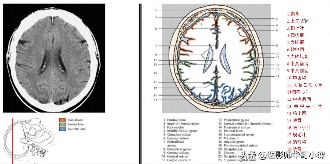 头颅（CT）解剖--精品图集