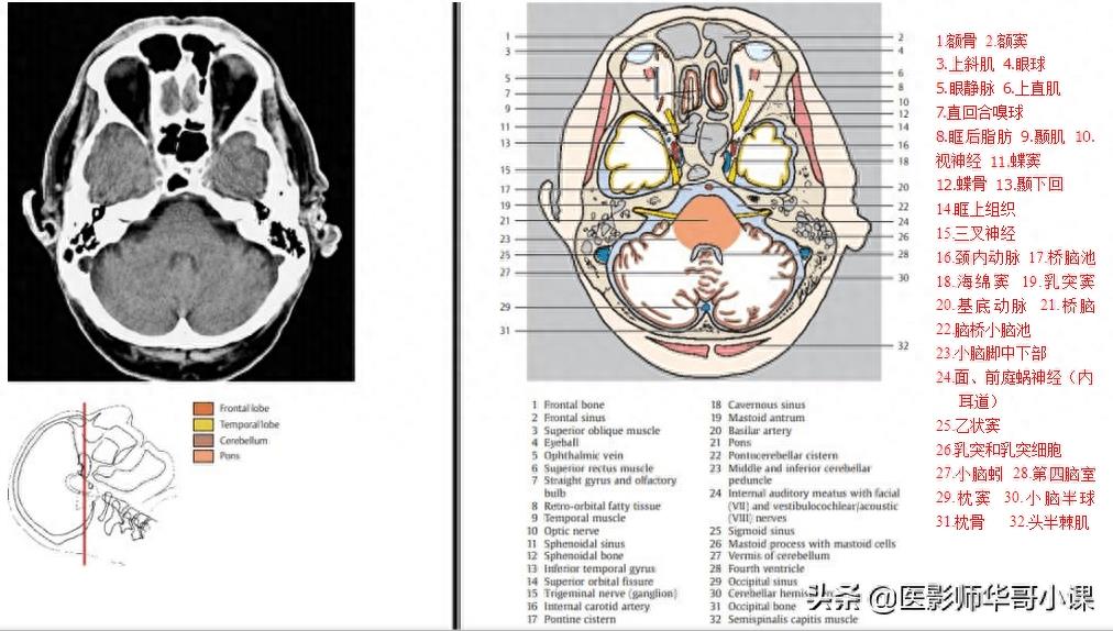 头颅（CT）解剖--精品图集