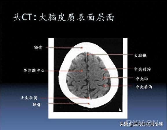 头颅（CT）解剖--精品图集