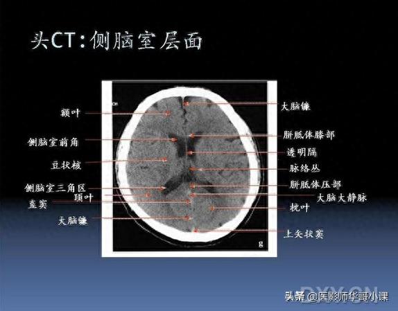 头颅（CT）解剖--精品图集