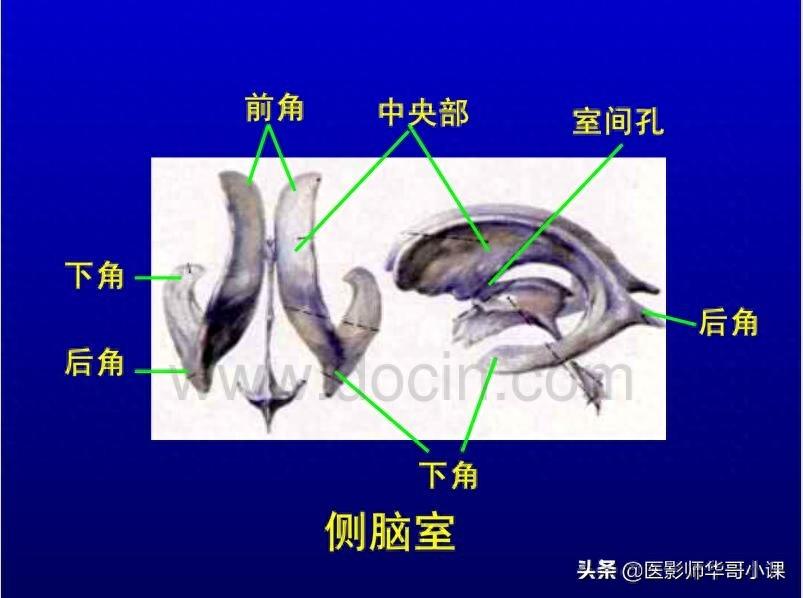 头颅（CT）解剖--精品图集