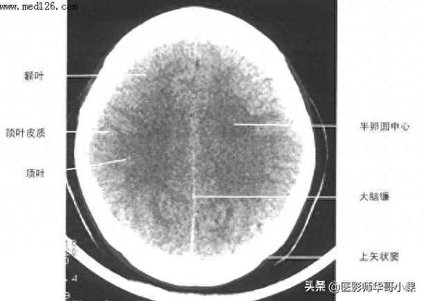 头颅（CT）解剖--精品图集