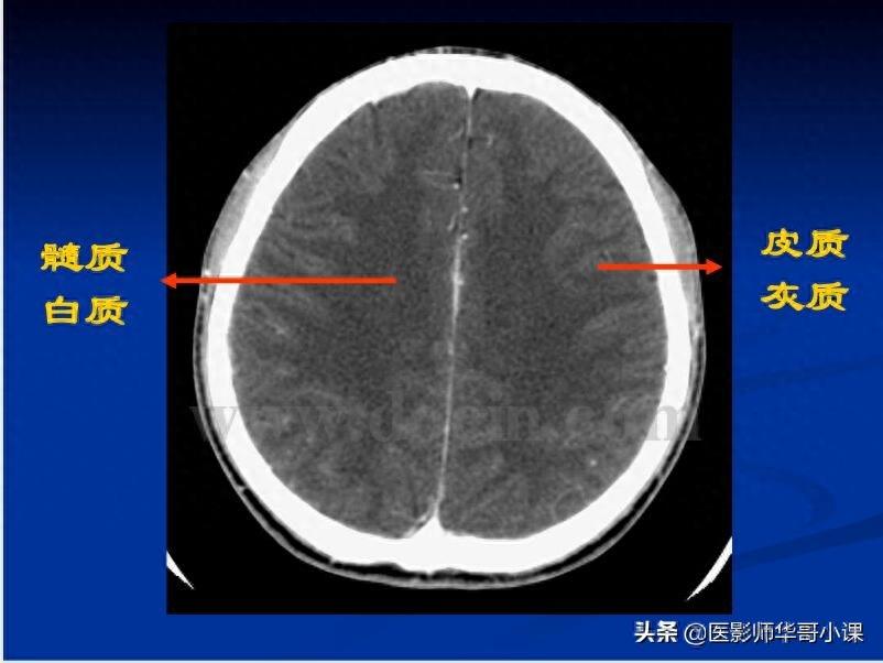 头颅（CT）解剖--精品图集