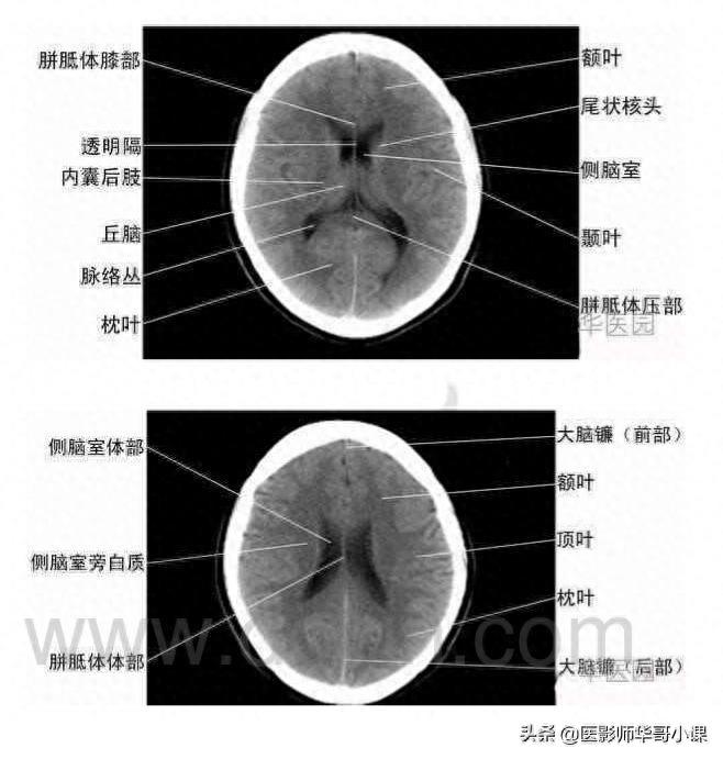 头颅（CT）解剖--精品图集