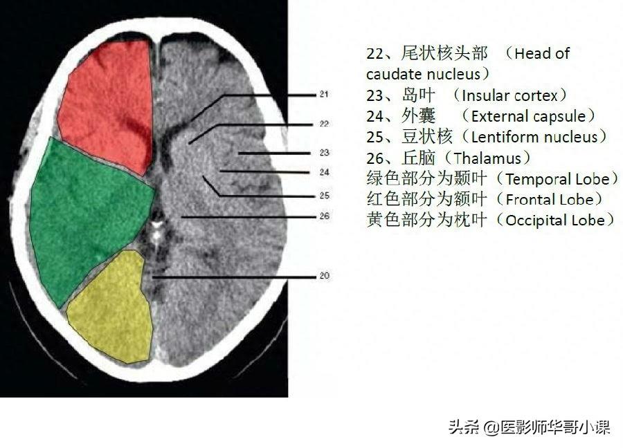 头颅（CT）解剖--精品图集