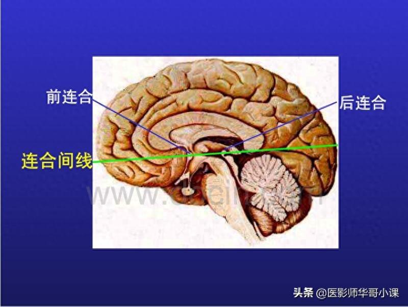 头颅（CT）解剖--精品图集