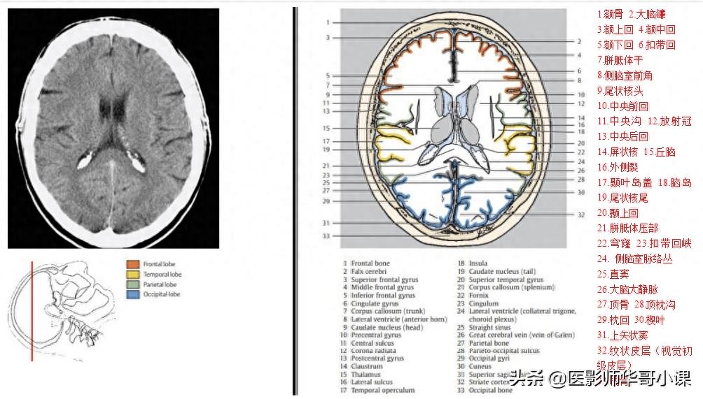 头颅（CT）解剖--精品图集