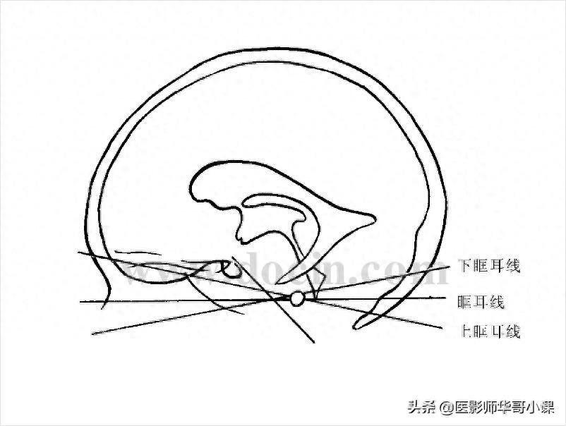 头颅（CT）解剖--精品图集