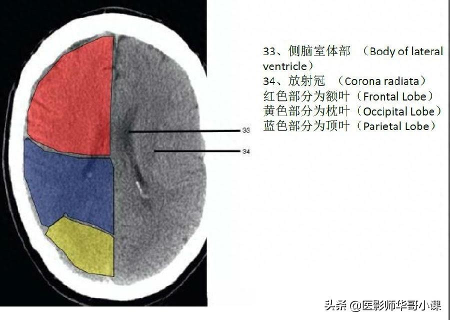 头颅（CT）解剖--精品图集