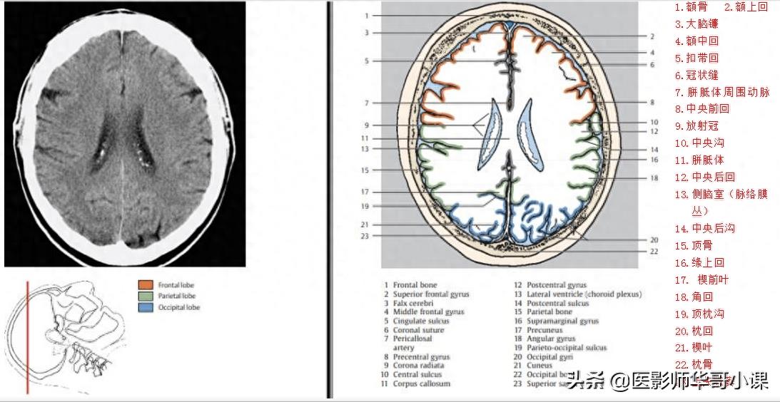 头颅（CT）解剖--精品图集