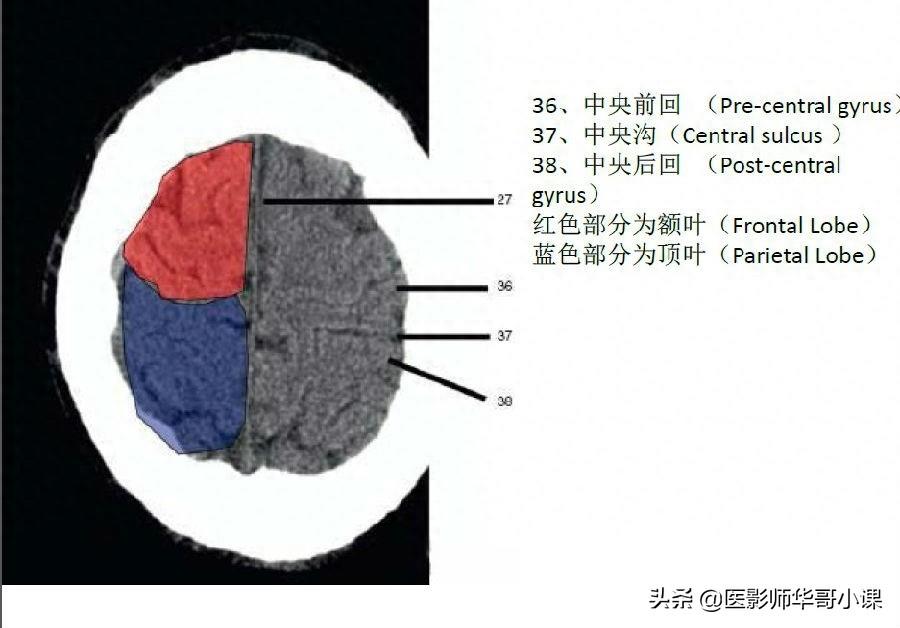 头颅（CT）解剖--精品图集