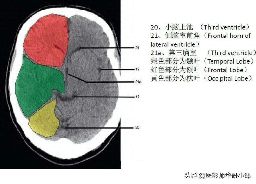 头颅（CT）解剖--精品图集