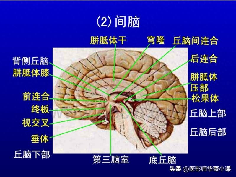 头颅（CT）解剖--精品图集