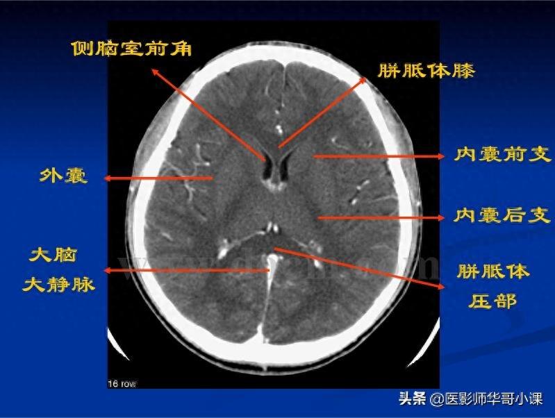 头颅（CT）解剖--精品图集