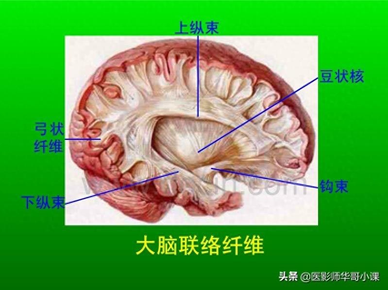 头颅（CT）解剖--精品图集